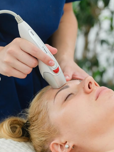 Radiofrecuencia Fraccionada