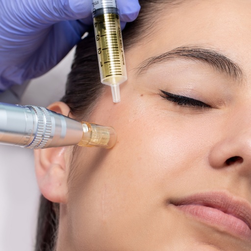 Dermapen Microneedling + Mesoterapia Virtual