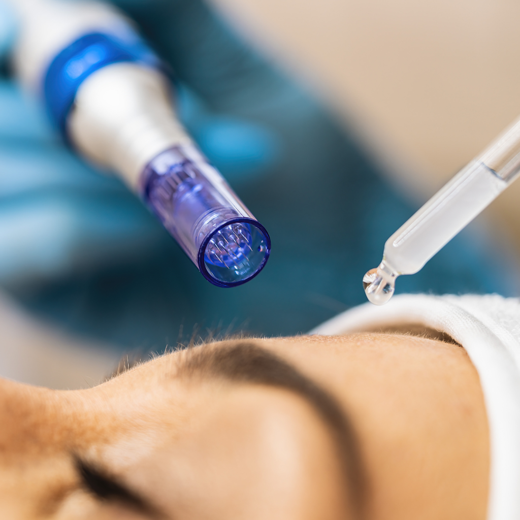 Microneedlling